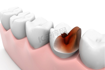 蛀牙虫卡通摄影照片_白底上的蛀牙。3D渲染