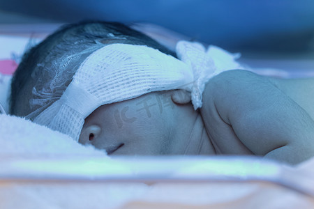 刚出生的婴儿新生儿黄疸下蓝色 Uv 光的照片
