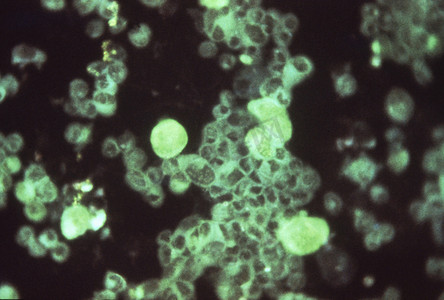 人胚胎肺中的巨细胞病毒