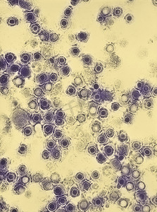 扫描电子显微镜显示单纯疱疹病毒粒子