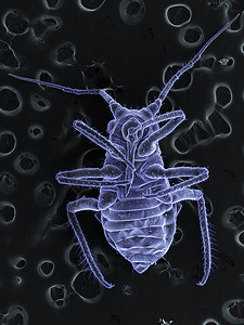 植物虱子的高真空扫描电子显微镜图像