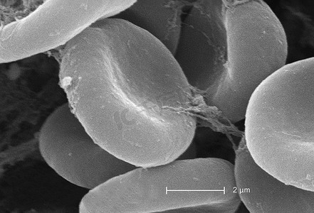 扫描电子显微镜显示红细胞和纤维蛋白
