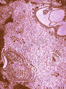 扫描电子显微镜摄影照片_扫描电子显微镜显示单纯疱疹病毒粒子