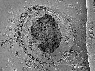 扫描电子显微镜摄影照片_巨型粉虫幼虫气孔的扫描电子显微镜