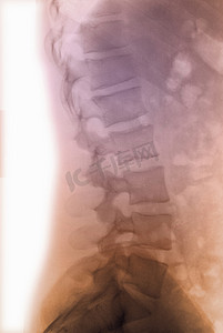 人体腰椎摄影照片_腰椎正常光片