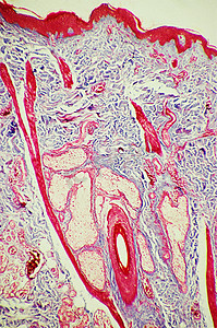 皮肤中的毛囊