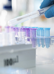 科学家准备拭子在实验室分析用于法医或亲子鉴定