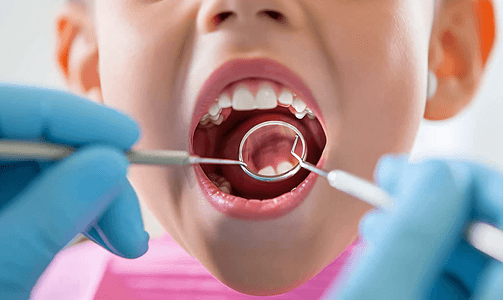暑期牙齿矫正摄影照片_医生检查儿童口腔牙齿健康特写