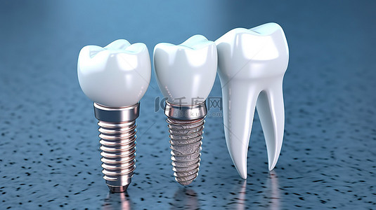牙齿种植牙背景图片_用于医疗演示的牙种植体的 3D 渲染
