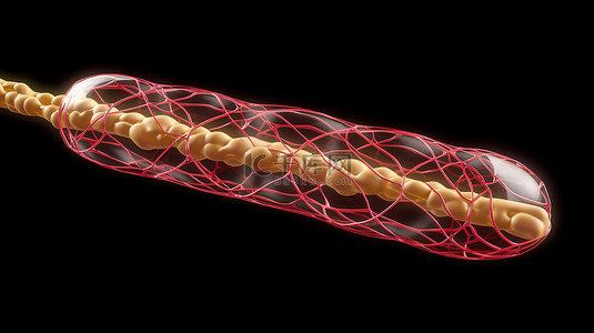 医疗血管背景图片_用于气囊血管成形术可视化的支架或导管 3d 模型