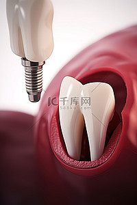 牙齿种植牙背景图片_种植牙我会损失多少钱