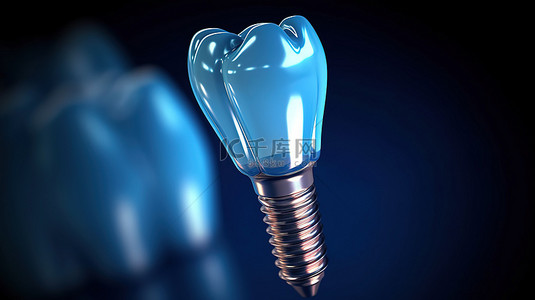 牙齿种植牙背景图片_3D 所示透明蓝色牙种植体组件的详细视图
