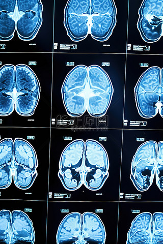 照片背景图片_核磁共振成像照片，其中一些显示大脑