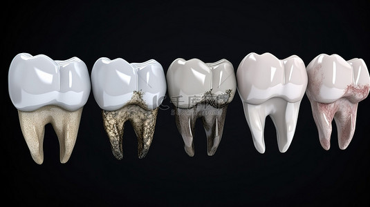 逼真的 3d 牙齿的集合呈现干净的脏和美白