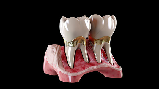 前磨牙牙王模型的 3D 渲染