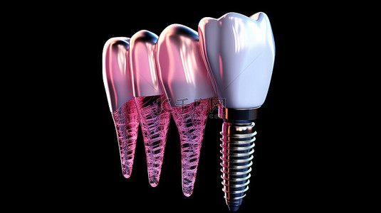 牙齿种植牙背景图片_透明牙种植体组件 3D 渲染的详细视图