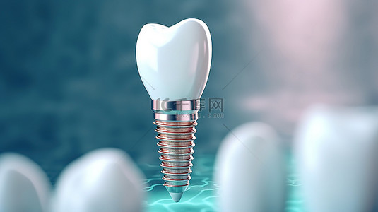 白牙闪光背景图片_讲台上完美牙种植体的 3D 渲染