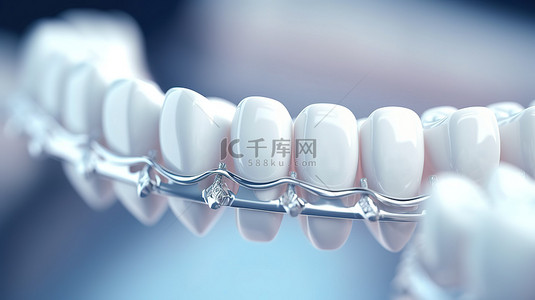 详细的 3D 渲染支撑牙齿特写，有选择地关注健康和过程