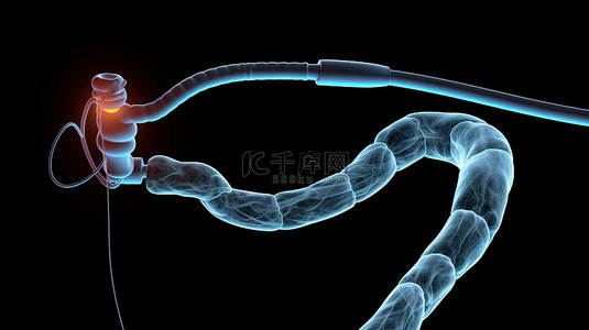 食管溃疡背景图片_用于 3d x 射线内窥镜检查以去除结肠息肉的线环