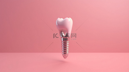 粉红色背景下的 3D 渲染牙种植体