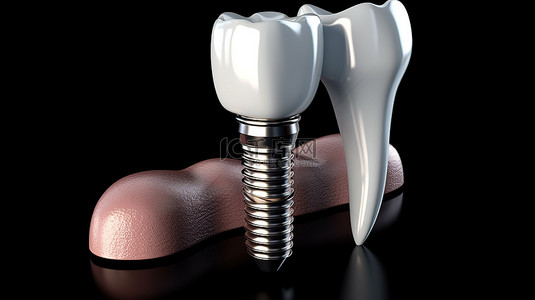 喉咙手术背景图片_牙种植体和假体的 3D 渲染