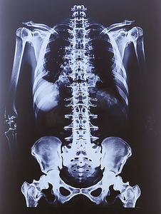 沮丧摄影照片_医疗保健 医疗放射学医生与病人看X光
