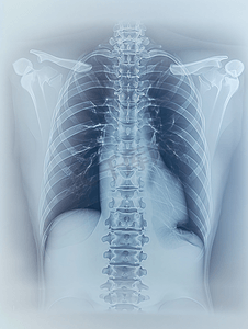 x射线图片摄影照片_医疗保健 医疗放射学医生与病人看X光