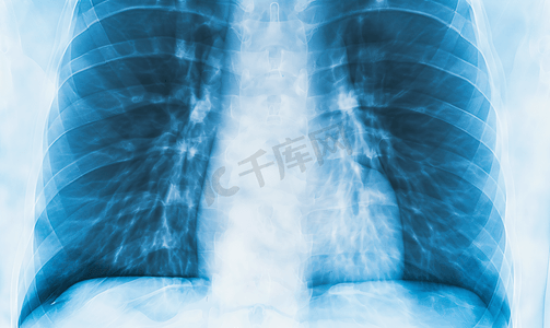 x射线图片摄影照片_医疗保健 医疗放射学医生与病人看X光