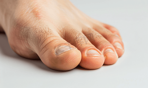 指甲甲床摄影照片_右脚脚指甲的伤痕