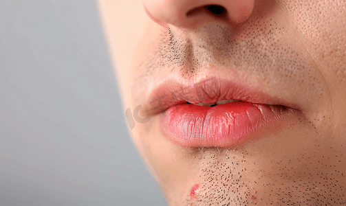 男性嘴唇有红圈唇疱疹等问题的信号
