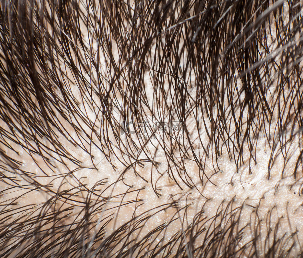 毛囊的结构头发的解剖结构插画图片素材_ID:422008024-Veer图库