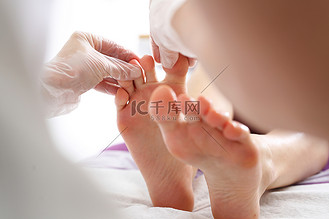 帕拉甲图片素材_脚趾和指甲真菌。女人在皮肤科医生.