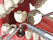 牙人类种植。牙科植入概念。人类的牙齿或