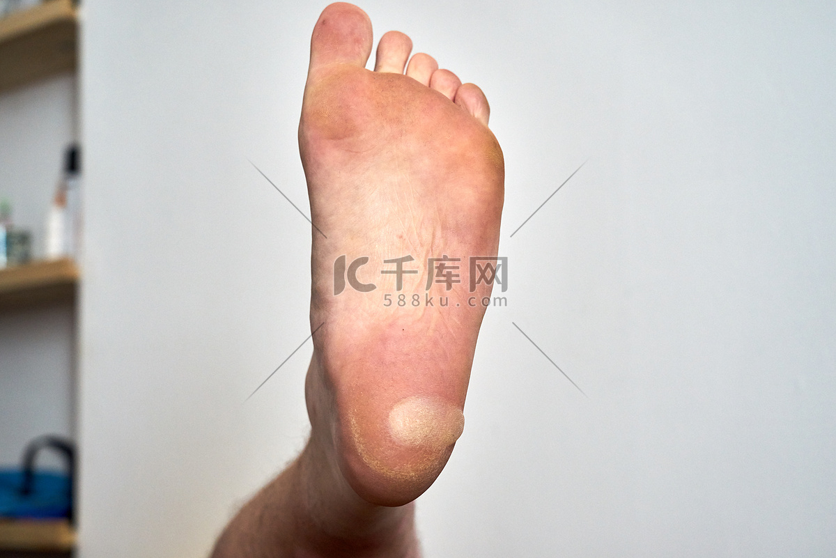 右脚脚踝有痣的女人代表什么（女人脚上7个位置长痣的运势分析超准的）-紫微星座网
