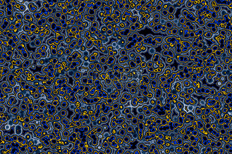 菌体形态:球菌,杆菌,螺旋菌