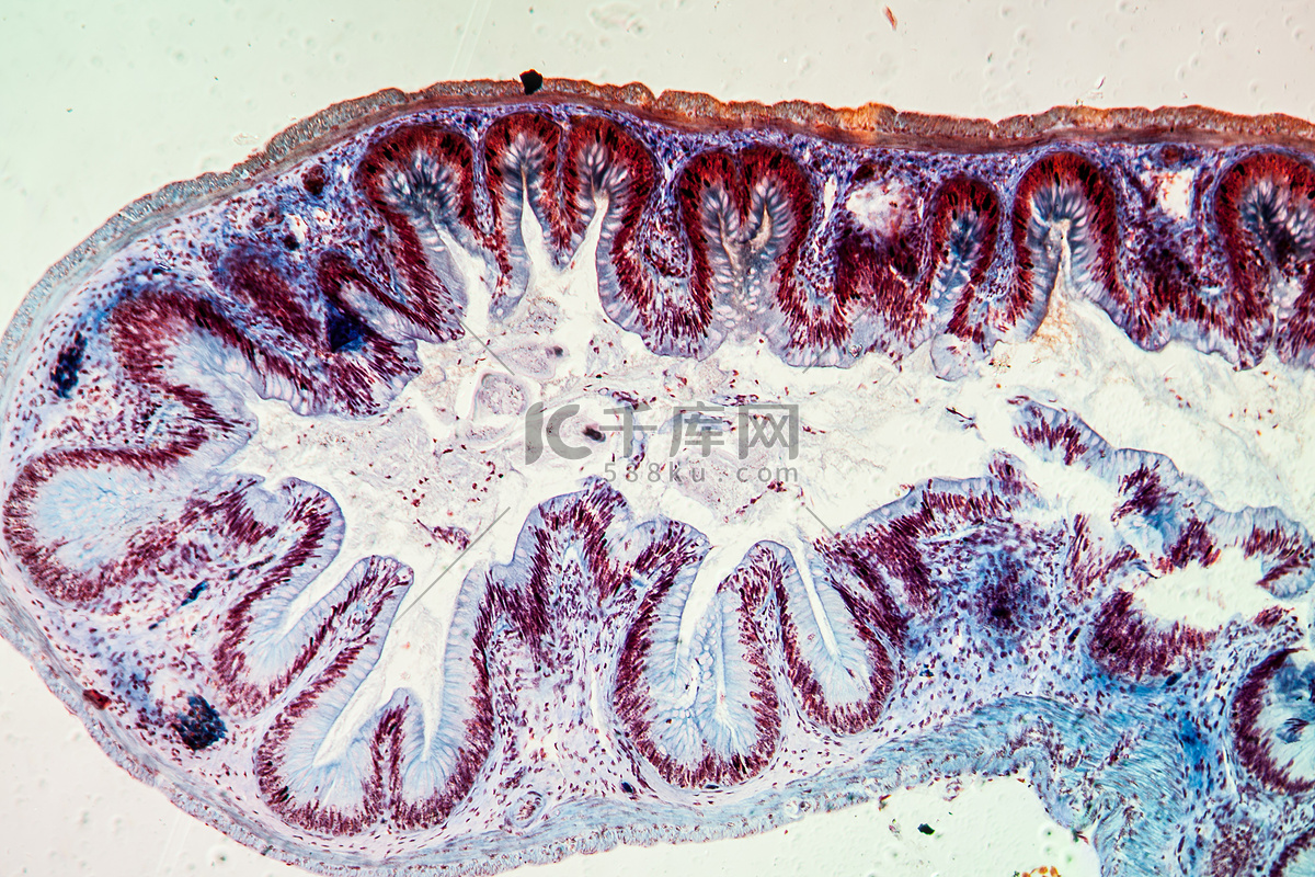 图17～21 绒毛结构的演变-功能组织学与胚胎学-医学