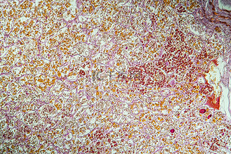 100x 显微镜下组织切片中的垂体