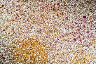 100x 显微镜下组织切片中的垂体