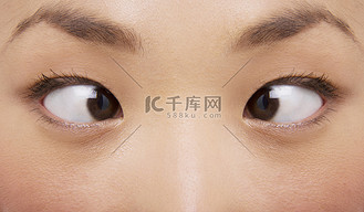 年轻女子斗鸡眼的极端特写