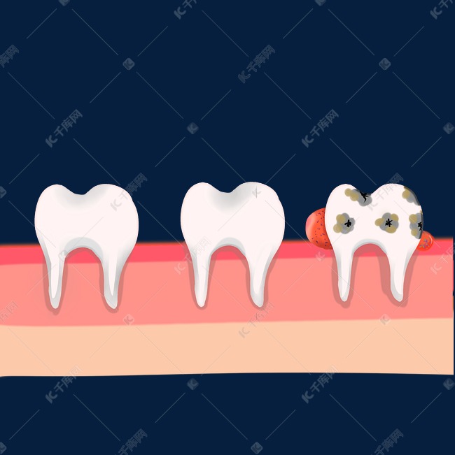 牙齿牙周炎素材图片免费下载 高清卡通手绘psd 千库网 图片编号 牙齿牙周炎素材图片免费下载 高清卡通手绘psd 千库网 图片编号