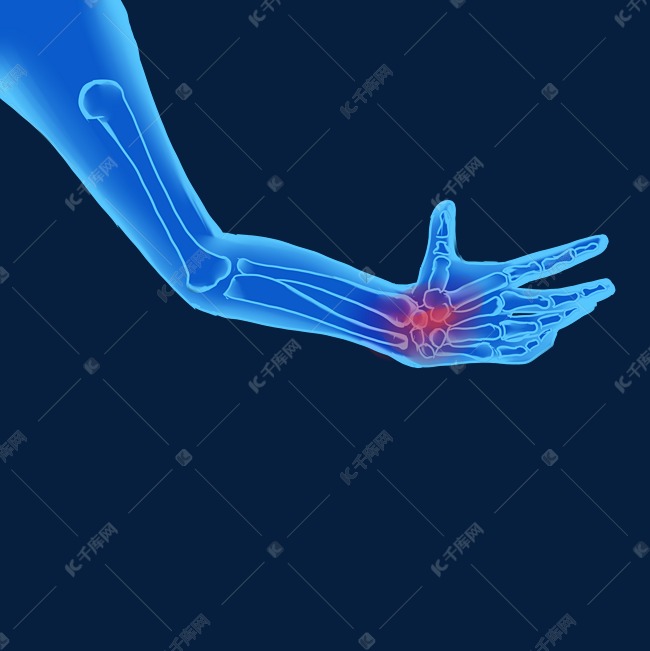 科技人体骨骼手腕