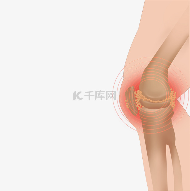 关节骨头痛风