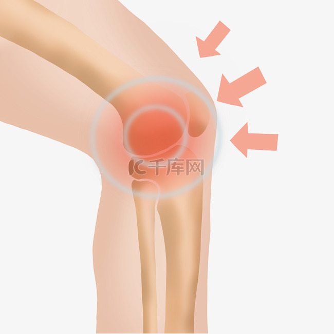 骨质疏松膝盖疼痛酸痛