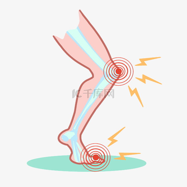 腿部关节痛风