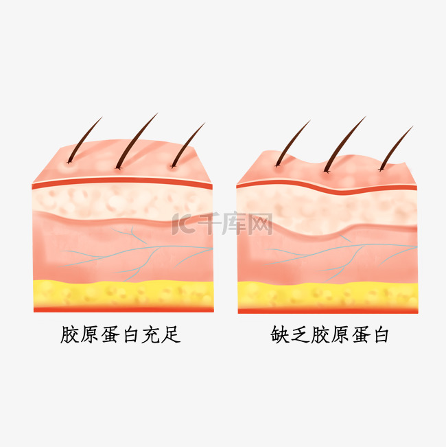 皮肤问题立体剖面图