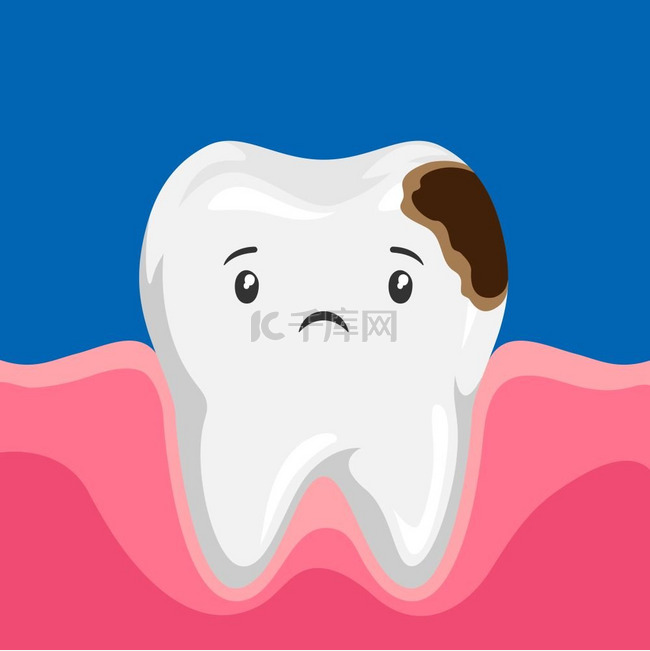 生病的牙齿与龋齿的插图。