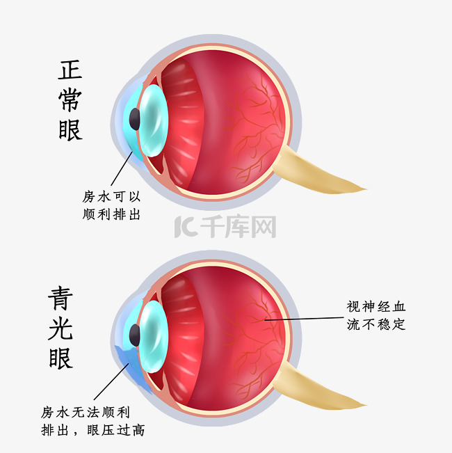 眼部疾病病变眼睛眼科医疗疾病