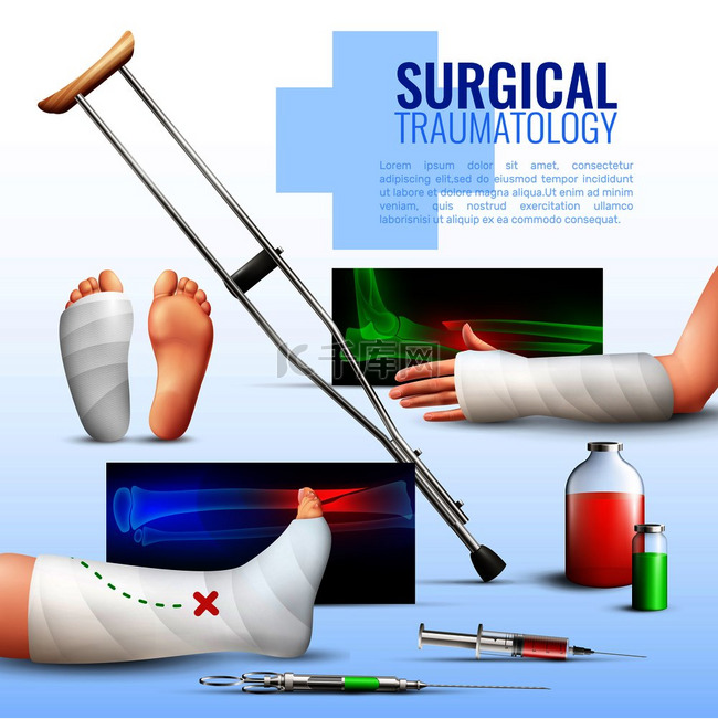 外科创伤学的现实概念与手足和腿