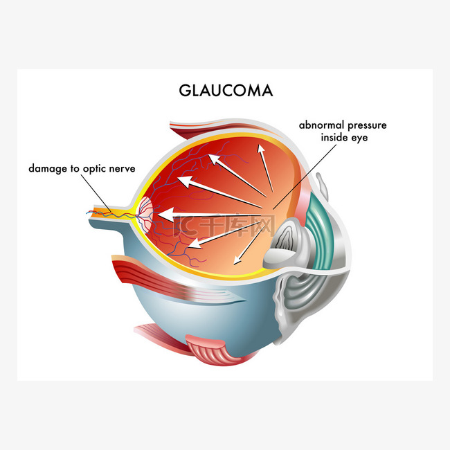 青光眼眼解剖