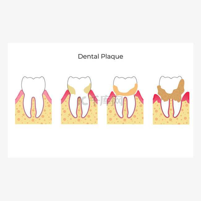 牙齿的矢量孤立图解 